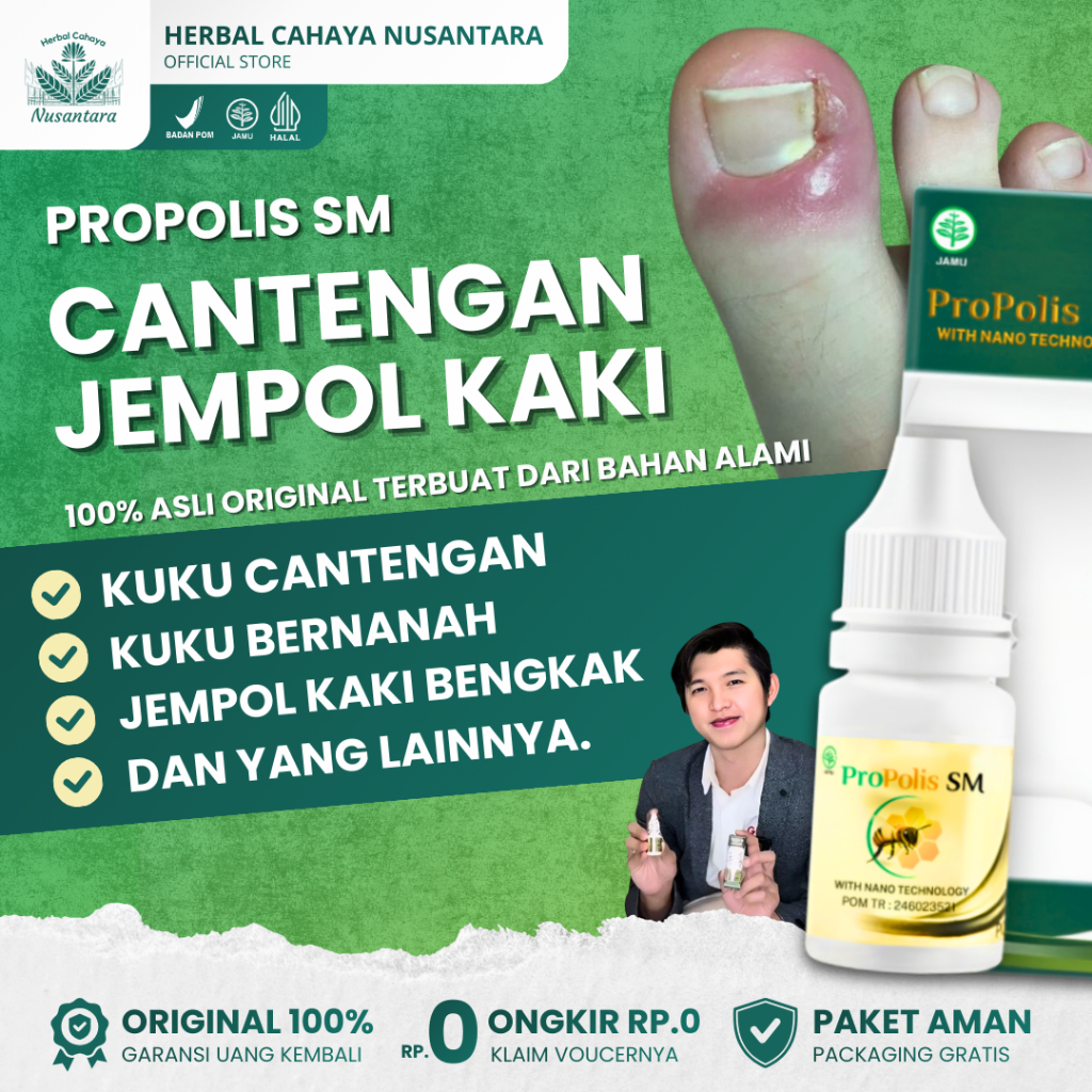 Jual Obat Cantengan Jempol Kaki Bengkak Bernanah | Kuku Berdarah