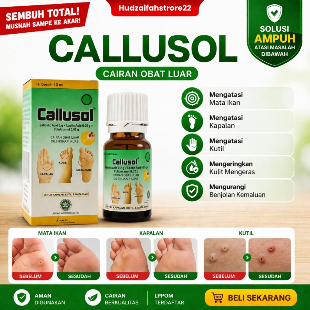 Jual Callusol 10ml Obat Kutil Mata Ikan Kapalan Kaki Pecah-Pecah ...