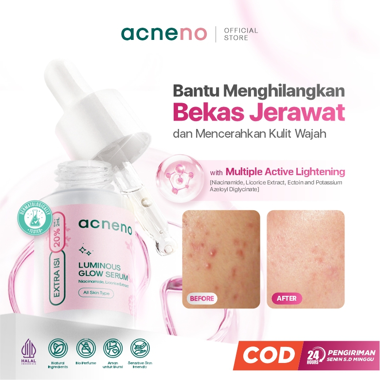 [PROMO TERBATAS] Serum Bekas Jerawat - Acneno Luminous Glow 12 ml | Serum Bantu Menghilangkan  Bekas Jerawat - BPOM & Halal