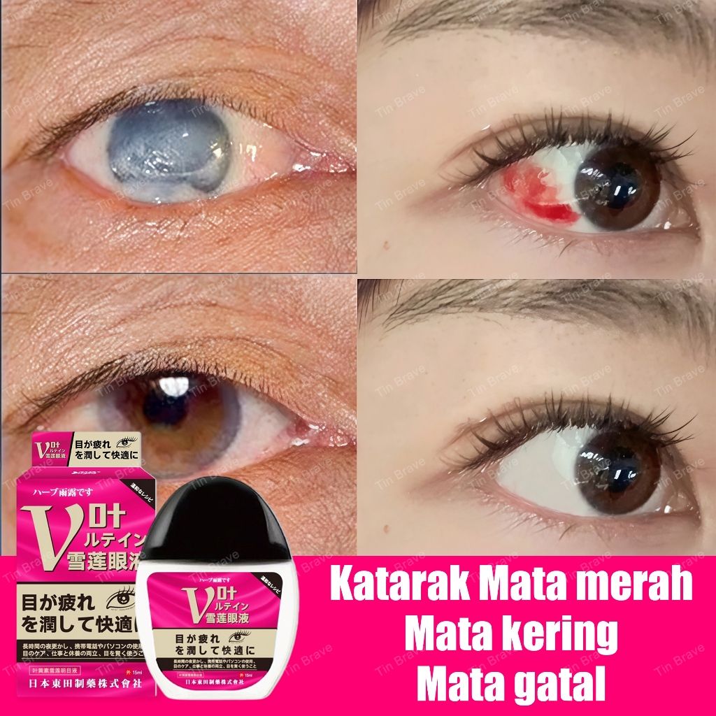 Jual obat tetes mata jepang obat mata katarak eye drop obat sakit mata ...