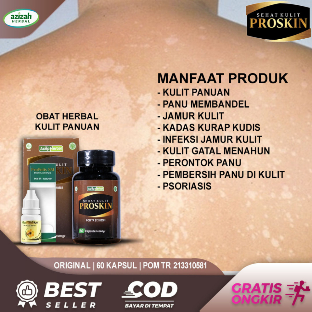 Jual Obat Panu Perontok Jamur Kulit Kadas Kurap Kudis Panuan Kulit ...