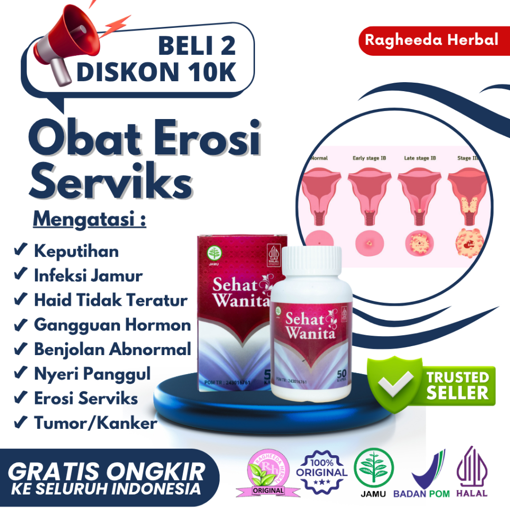 Jual Obat Erosi Serviks, Infeksi Serviks Luka pada Leher R4him Wanita ...
