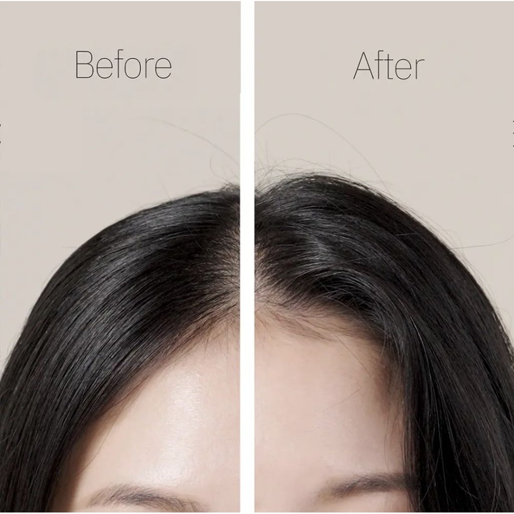 Jual Ryo Shampoo Root gen Hair Loss Perawatan Rambut Rontok Volume ...