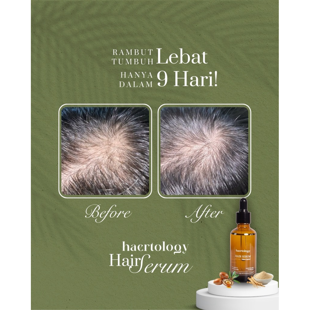 Jual Haertology Hair Serum | Shopee Indonesia