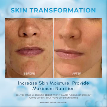 Dricha Micellar Water (All Skin Type)