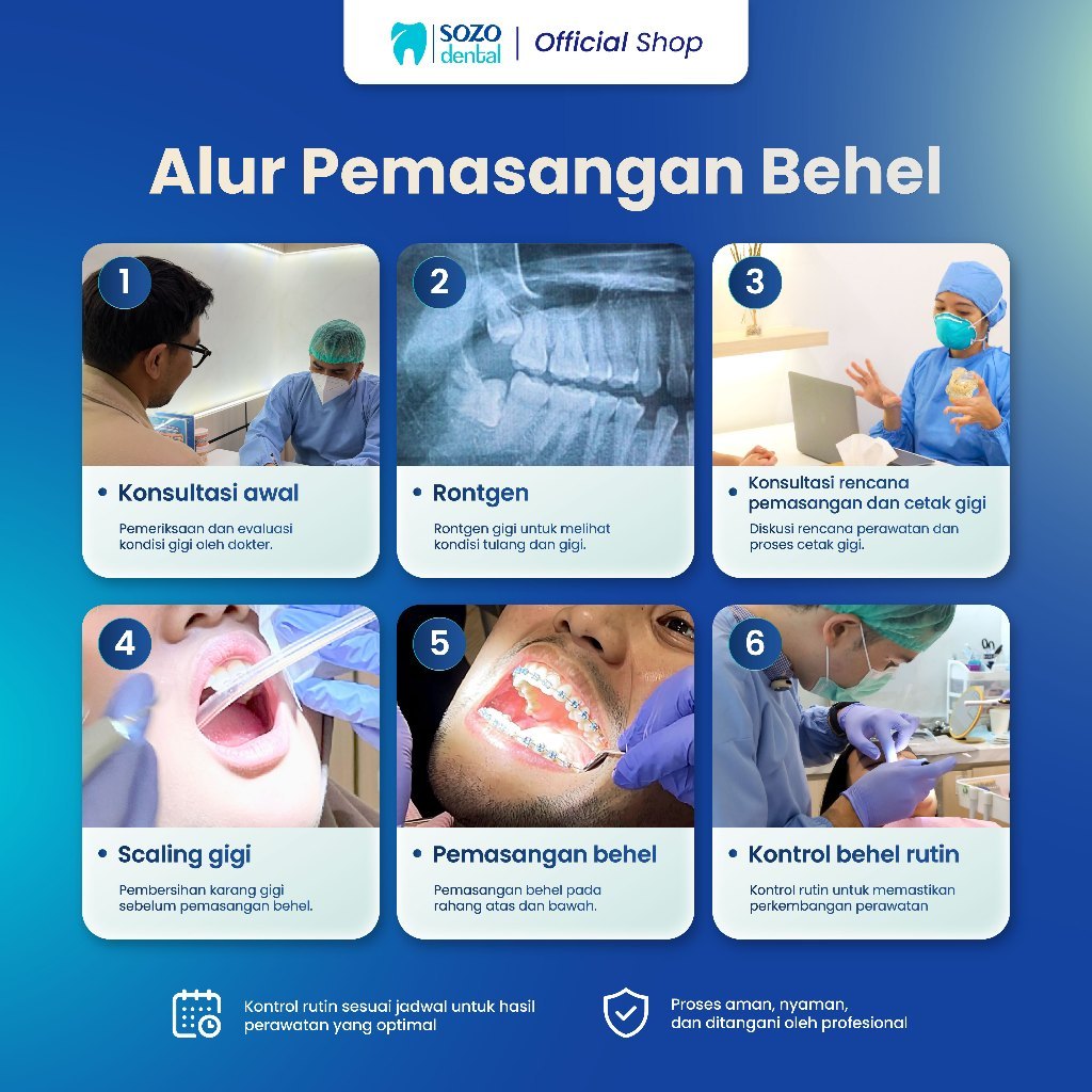 Jual Sozo Dental - Behel Metal DELUXE Rahang Atas Bawah + Basic Scaling ...