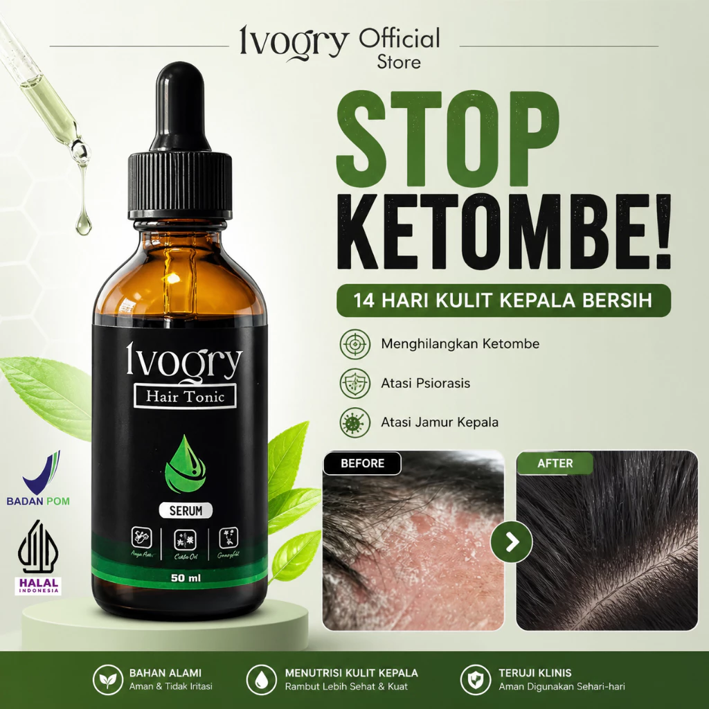 Ivogry Serum Ketombe & Kulit Kepala Gatal | BPOM | Halal | 55ml - foto 1