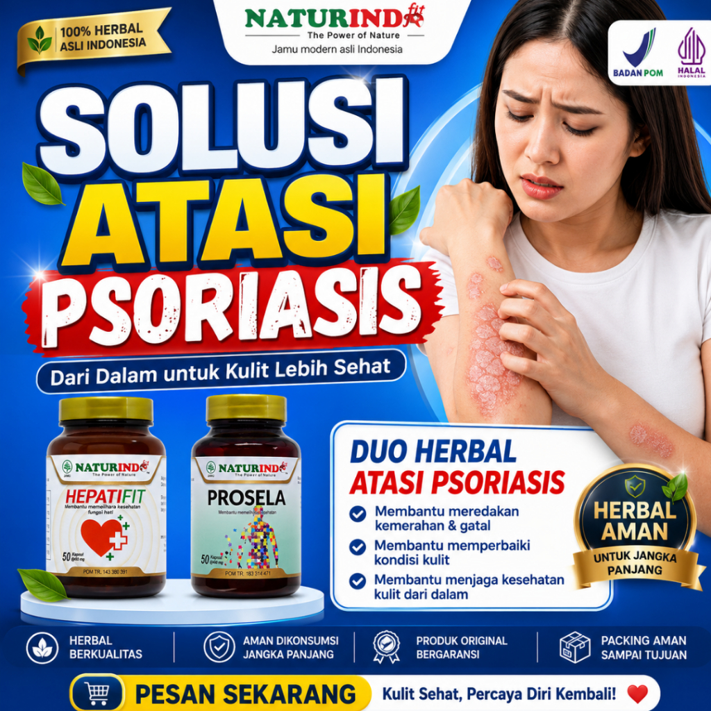 Obat Psoriasis Autoimun Nyeri Sendi Lupus Obat Gatal Alergi Biduran Herbal Naturindo Hepatifit