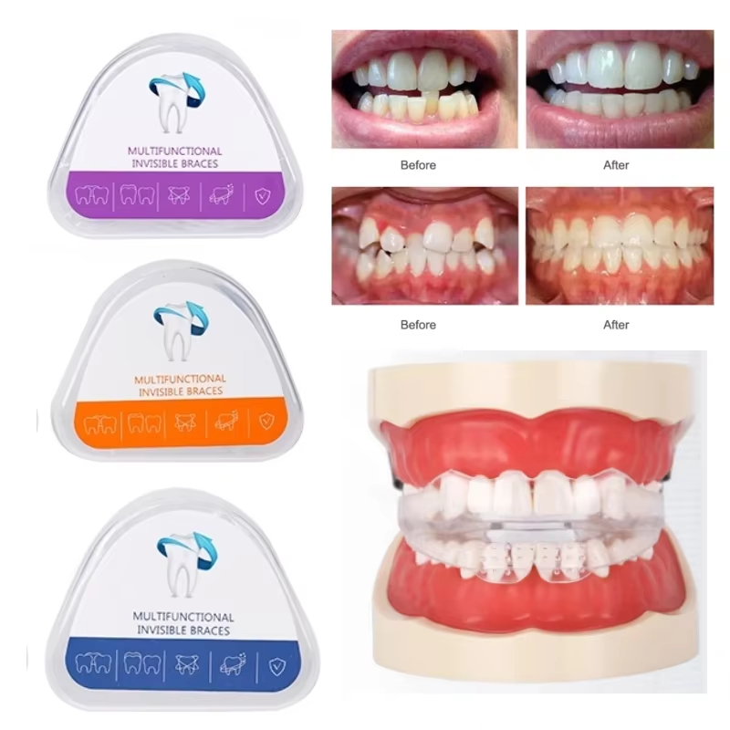Jual Aligner Terlengkap & Harga Terbaru Juli 2026 | Shopee Indonesia