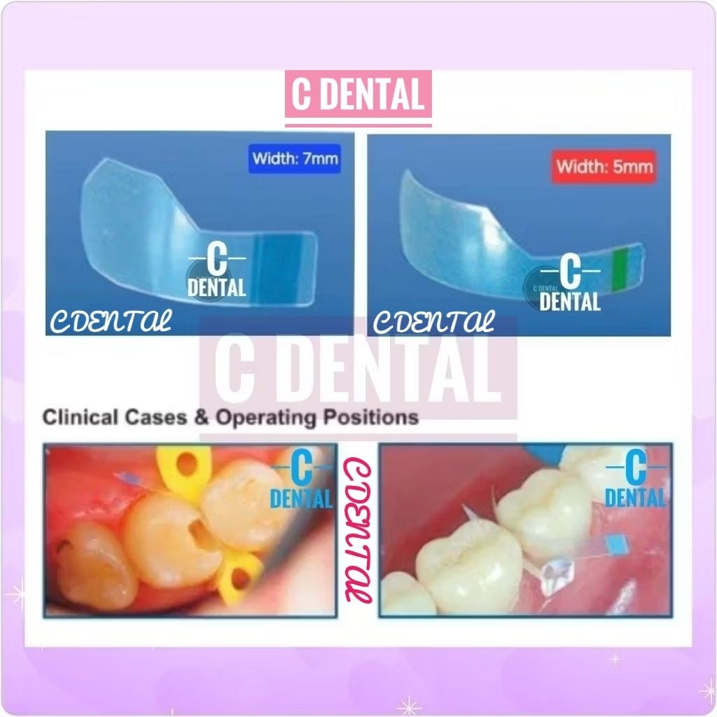 Jual Dental Posterior Proximal Matrix Transparan Polyester Celluloid ...