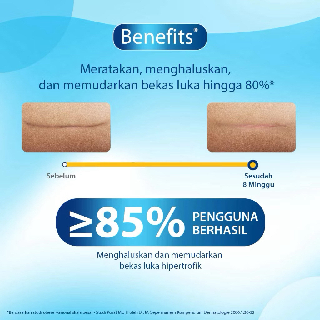 Dermatix Ultra 15gr Cream Penghilang Bekas Luka, Jerawat - foto 5