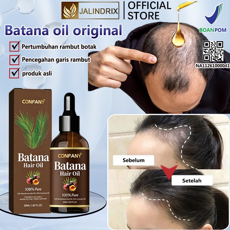 Jual Bpom batana oil penumbuh rambut original hair serum penumbuh ...