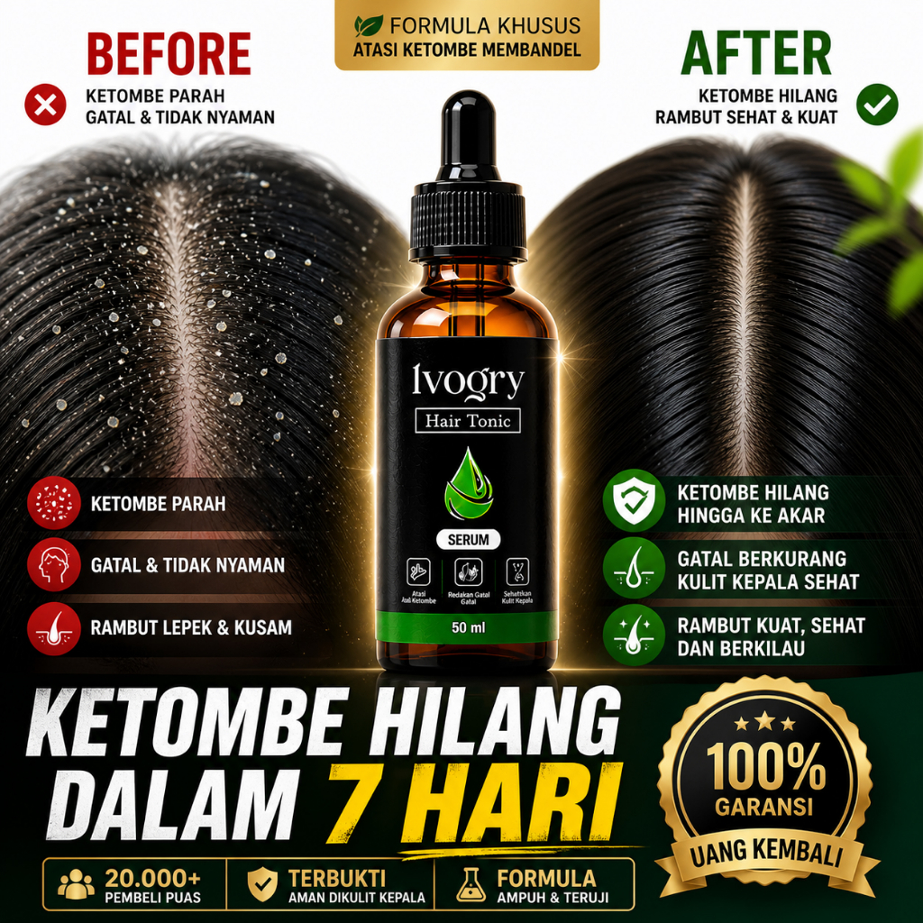 IVOGRY Serum Ketombe Bekerak dan Gatal foto 1