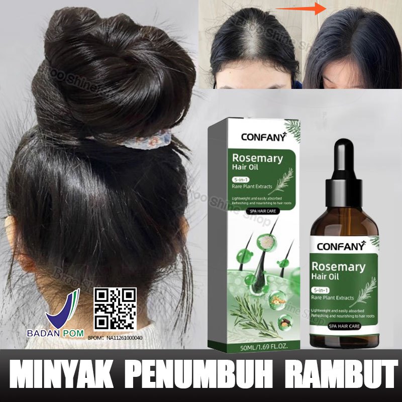 Jual Minyak Rosemary Penumbuh Rambut Cepat Dan Tebal Original 100% ...
