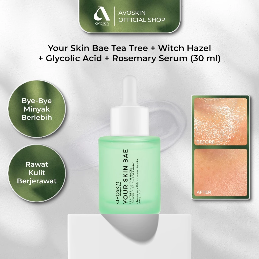 Pratinjau Serum Avoskin Your Skin Bae Tea Tree 30ml-Untuk Kulit Berjerawat