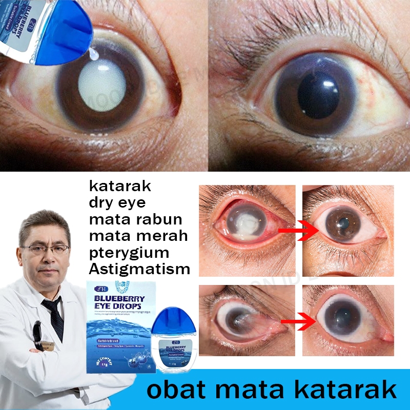 Jual Obat mata katarak Blueberry Eye drop Obat mata merah Pengobatan ...