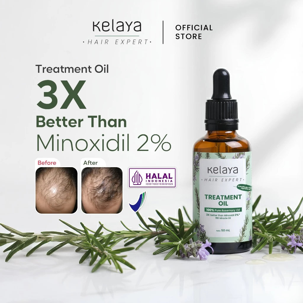 Pratinjau Kelaya Hair Expert Rosemary Oil 50ml 3X Lebih Ampuh Dari Minoxidil Penumbuh Rambut Rontok & Kering