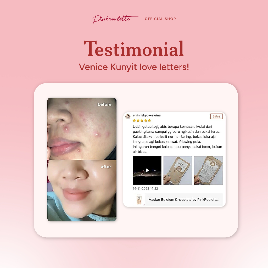 Jual Pinkroulette Venice Turmeric Organic Facemask | Shopee Indonesia