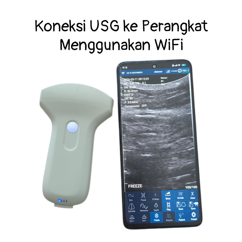 Jual Alat Usg Terlengkap & Harga Terbaru Juli 2026 | Shopee Indonesia