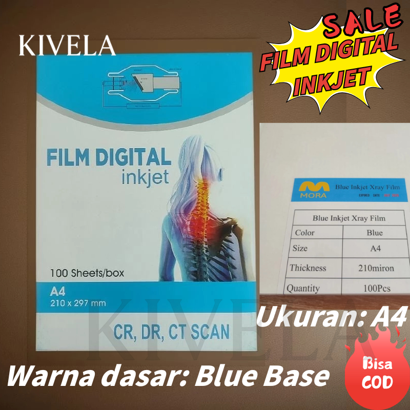 Jual Medical Dry Film Inkjet Radiology DR CR Rontgen X-Ray CT-Scan ...