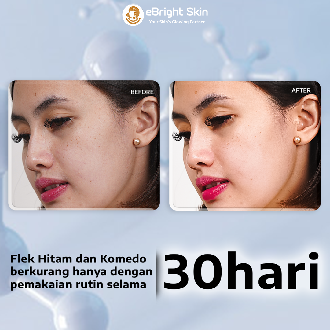Jual eBright Skin Serum Flek Hitam - Stay Mild AHA-BHA-PHA 10% ...