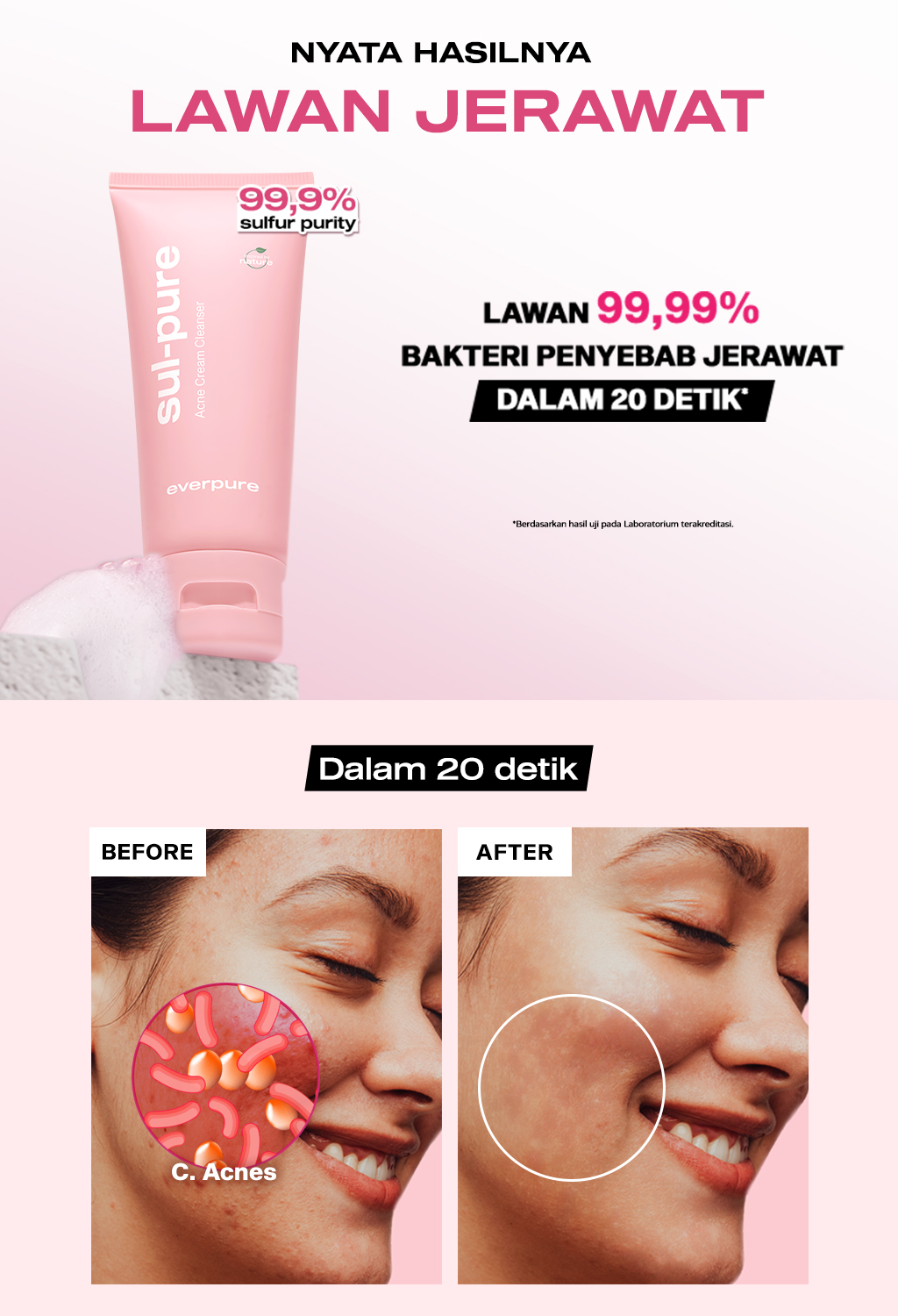 Jual EVERPURE Sul-Pure Acne Cream Cleanser with BHA - Sabun Cuci Muka ...