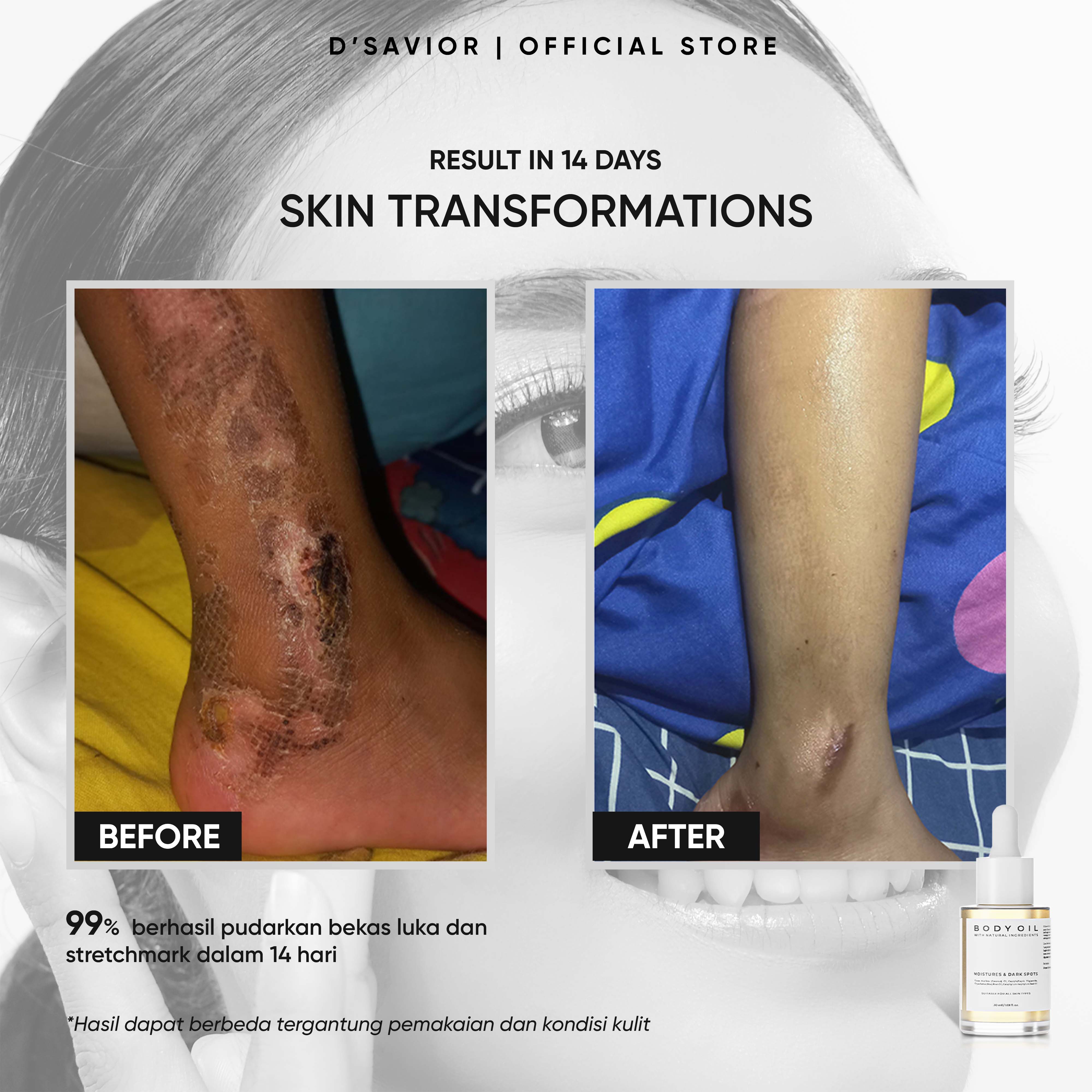 Jual [SPECIAL MEMBER] D'SAVIOR paket Dark Spot Solution | Brightening ...