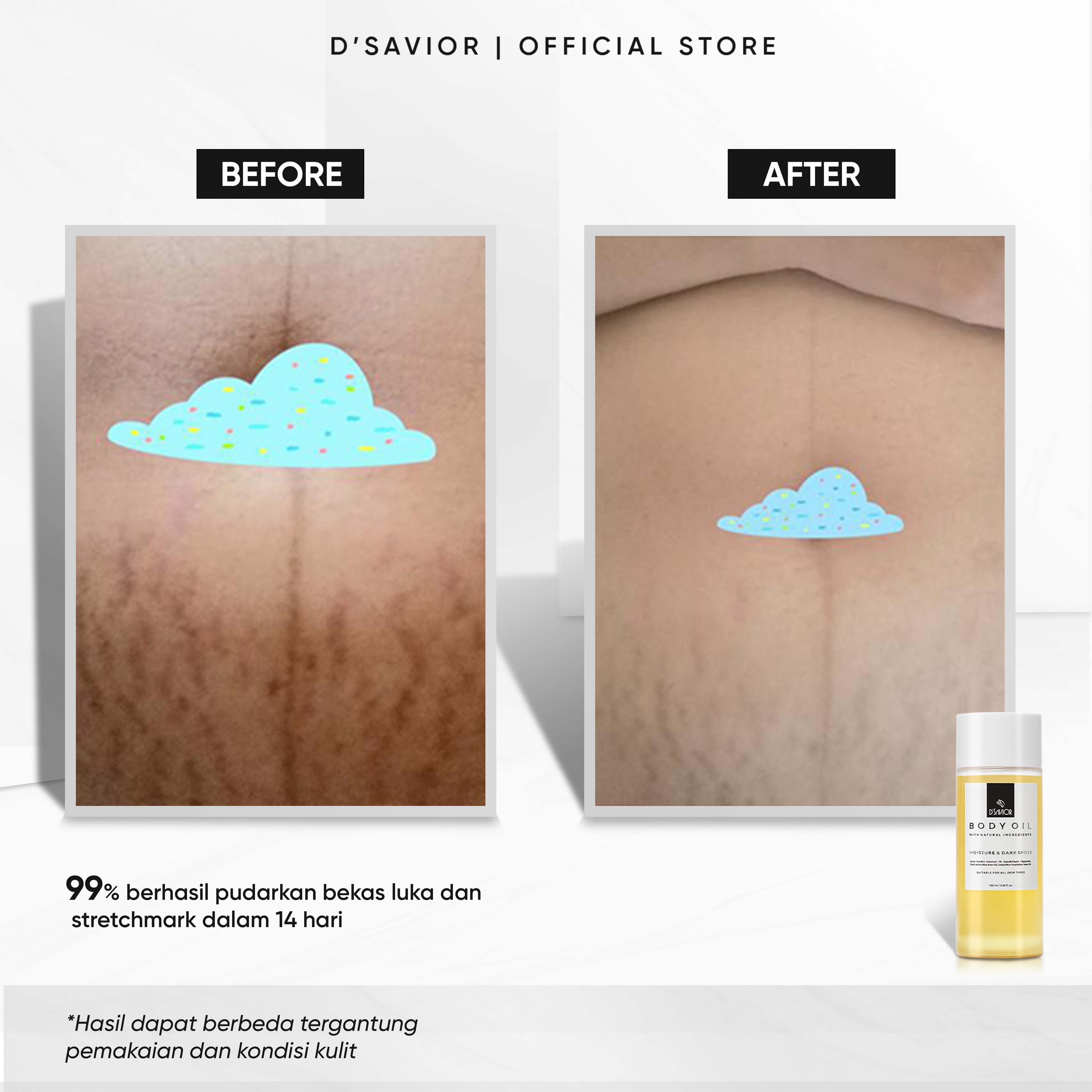 Jual D'SAVIOR Extra Darkspot Solution for Sensitive Skin | Body Oil 100 ...