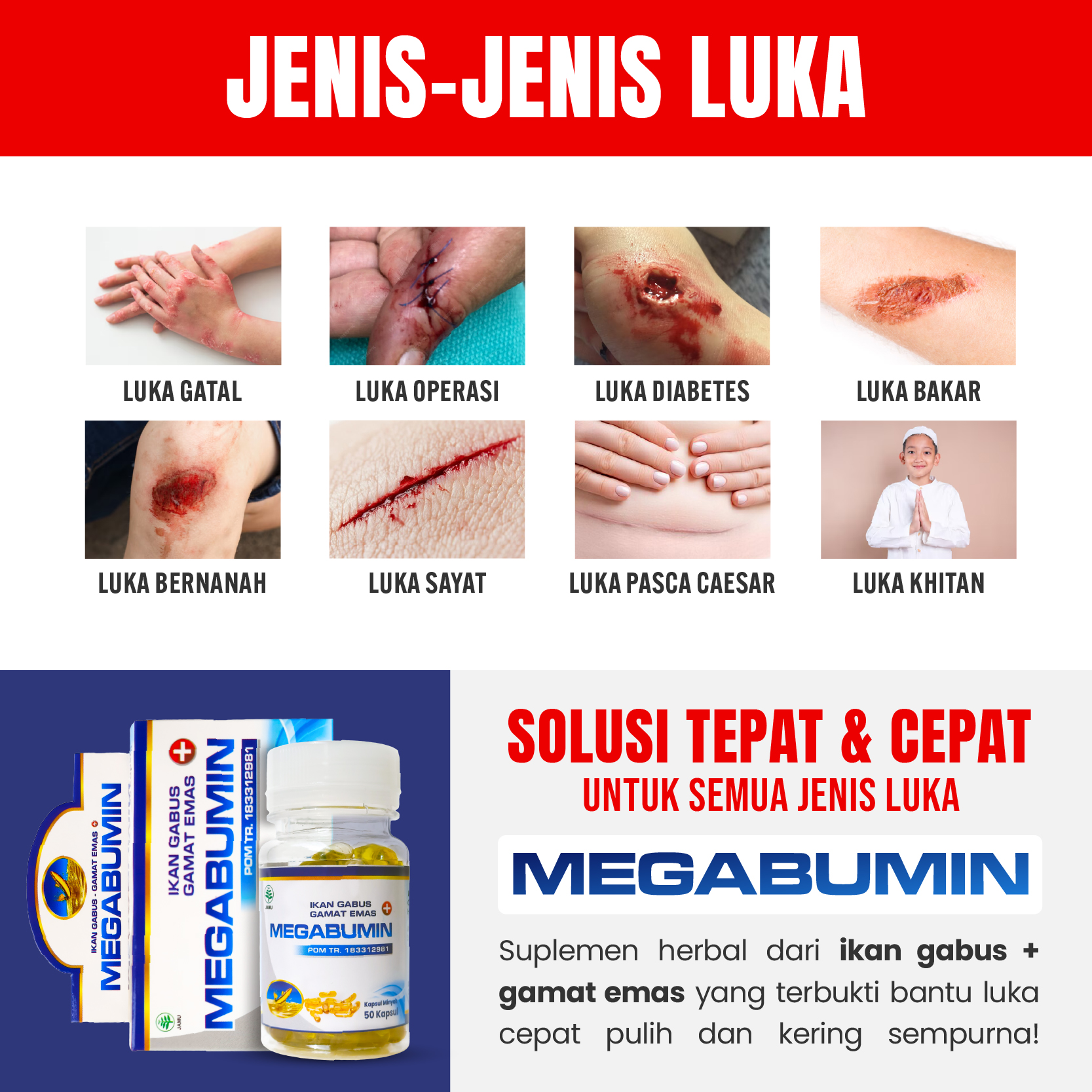 Jual Megabumin - Kapsul Minyak Ikan Gabus Kutuk Plus Gamat Emas Obat ...
