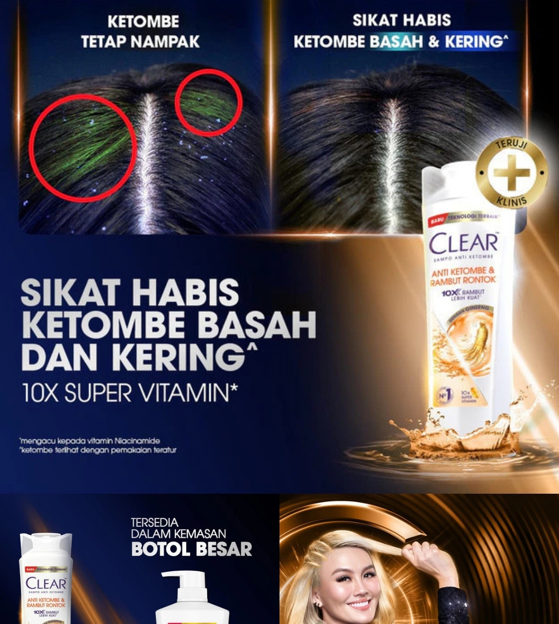 Jual CLEAR Shampoo Anti Ketombe & Rambut Rontok 300ml x (2 PCS ...