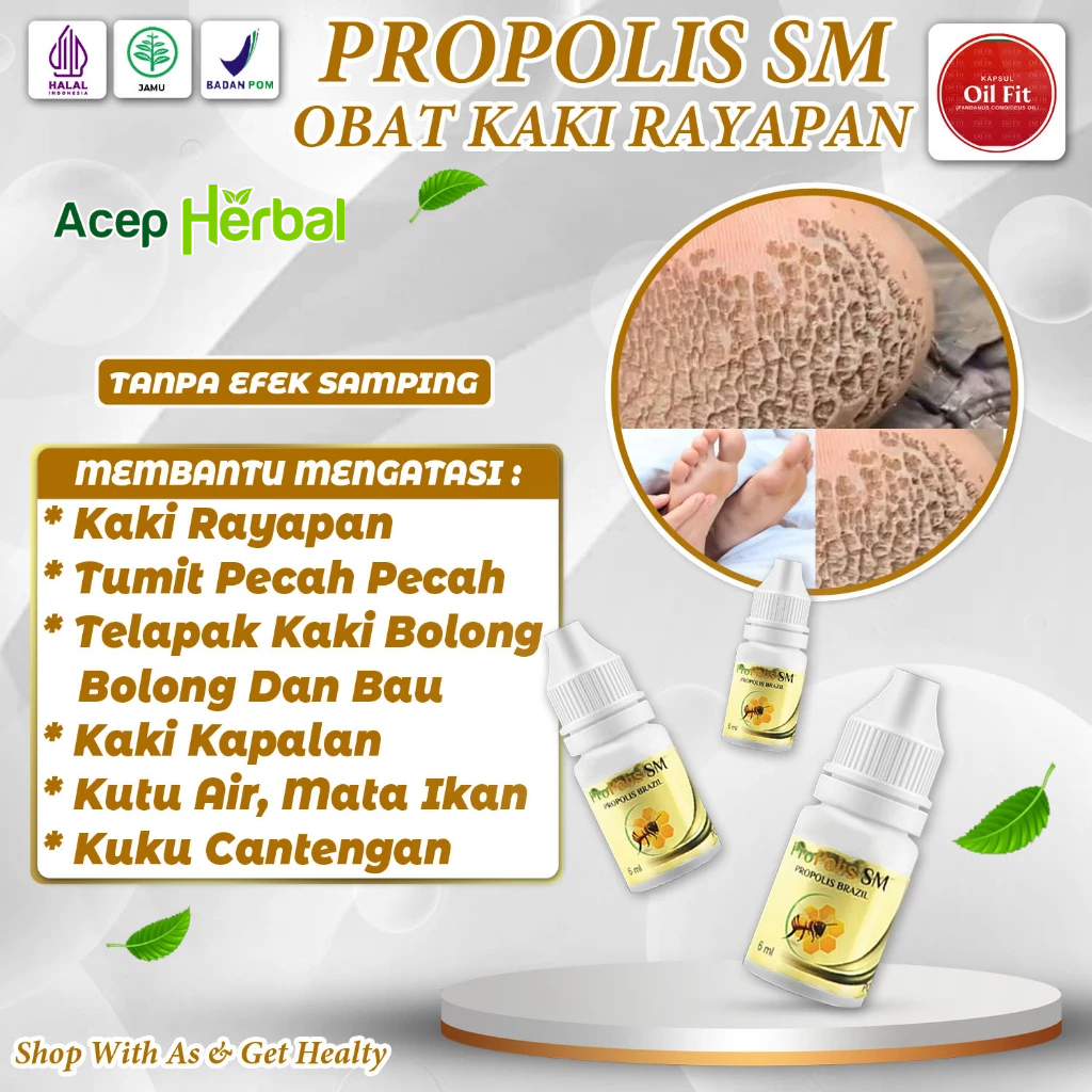 Jual Obat Kaki Rayapan Telapak Kaki Bolong Bolong Tumit Pecah Pecah Kutu Air Kaki Kapalan Mata