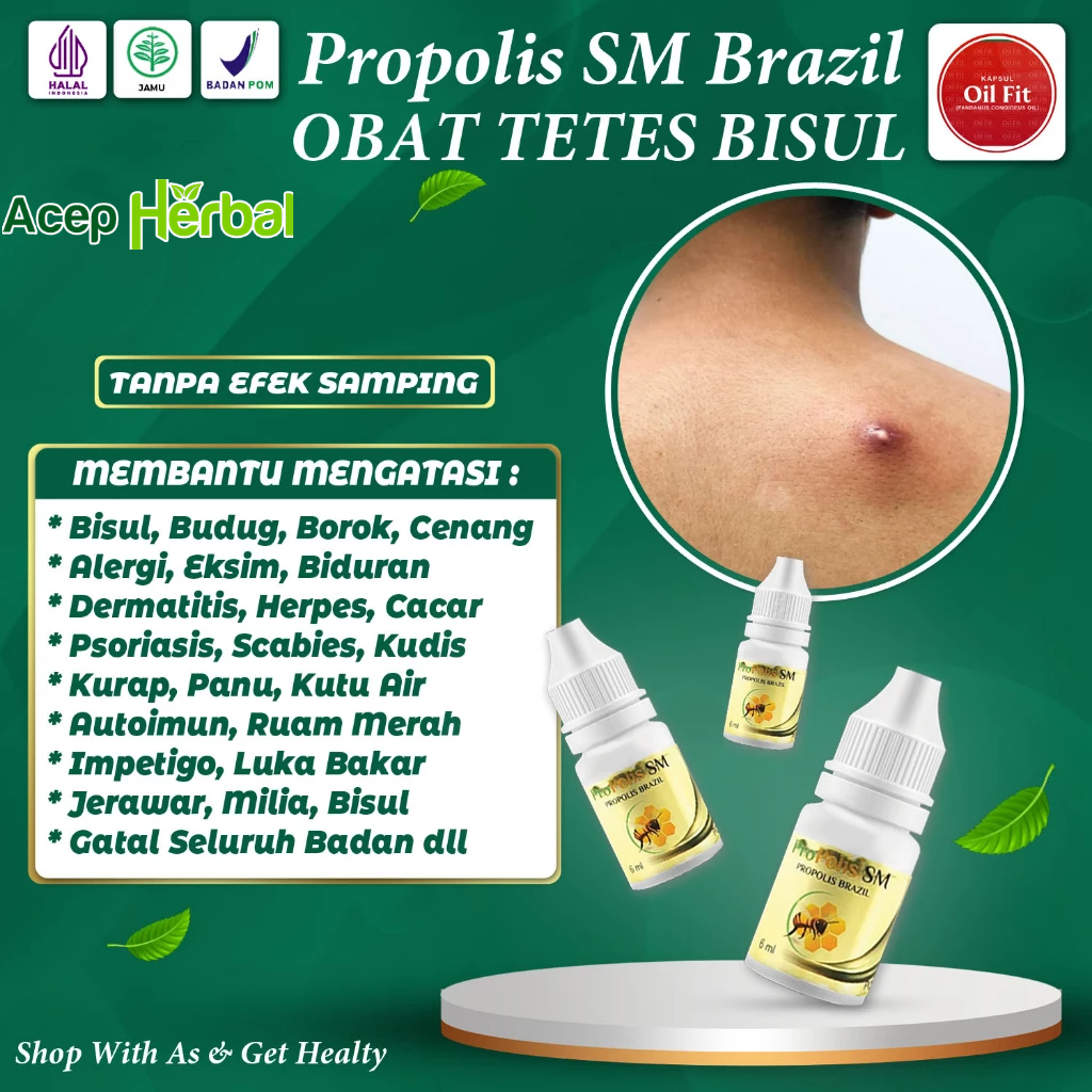 Jual Obat Bisul Bayi Anak dan Dewasa Tetes Salep Bisul Bernanah Pada