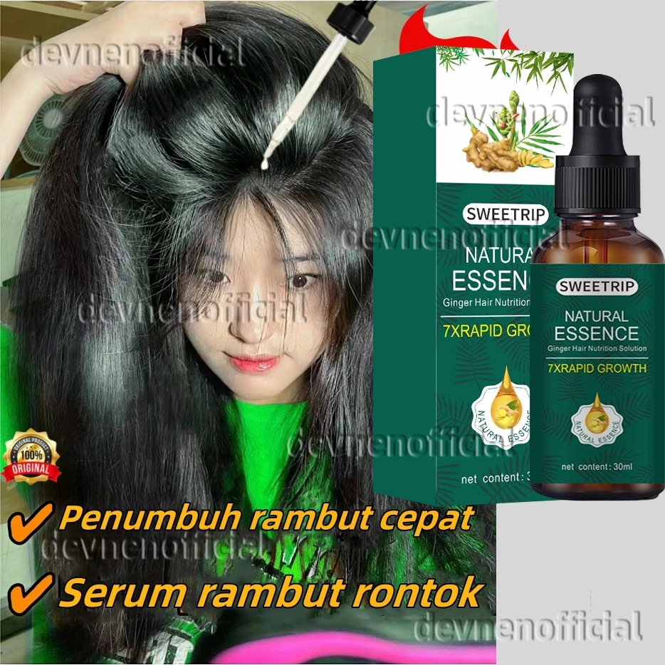 Jual SWEETRIP Serum Penumbuh Rambut Botak Penumbuh Rambut cepat dan ...