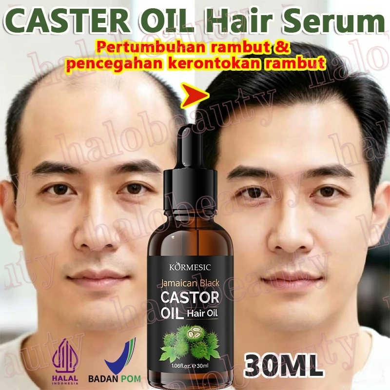 Jual Obat Penumbuh Rambut Terlengkap & Harga Terbaru Juli 2026 | Shopee ...