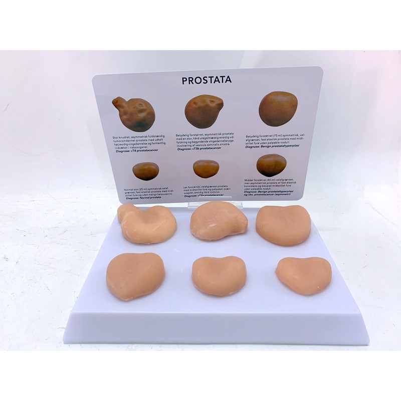 Jual New Male Prostate Genital Anatomy Pelvic Sagittal Section Teaching ...