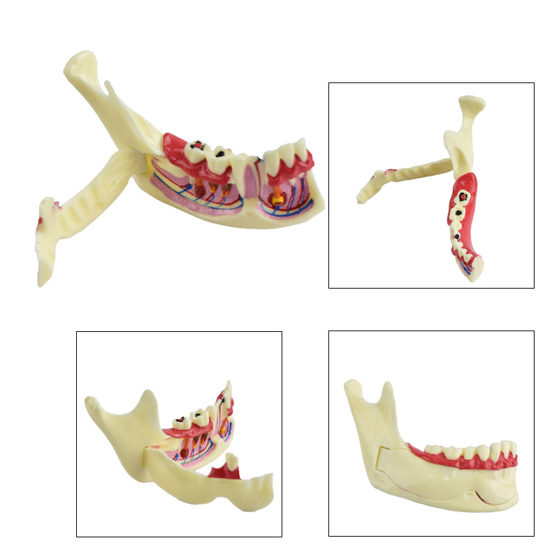 Jual Dental Endodontic Mandible Tissue Anatomical Model Dental ...