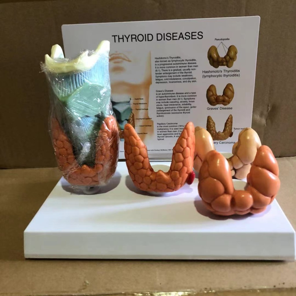 Jual Thyroid disease Lesion Anatomical Model Thyroid Anatomy teaching ...