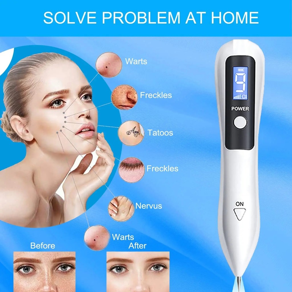 Jual Skin Tag Remover Wart Berrugas Eliminator LED Plasma Pen ...