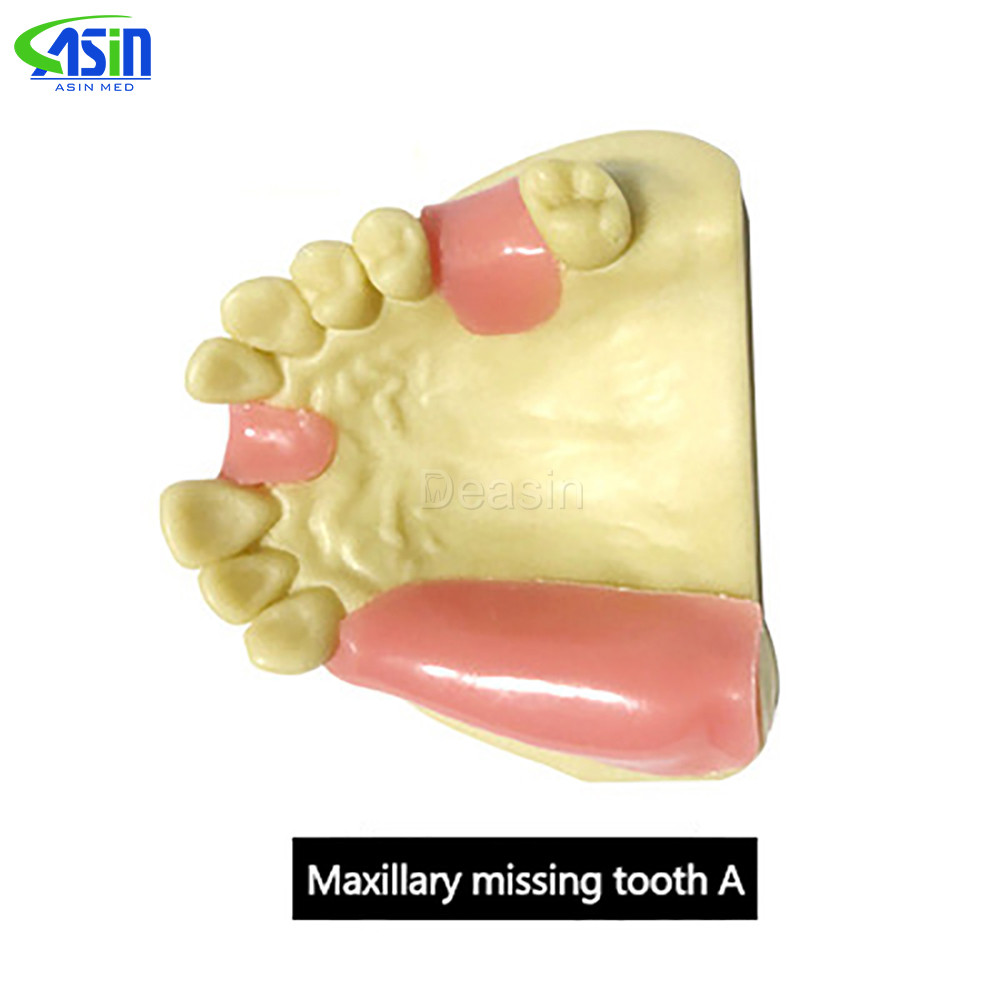 Jual Maxillary Missing Tooth Model Bone Imitating Oral Teaching Aids ...