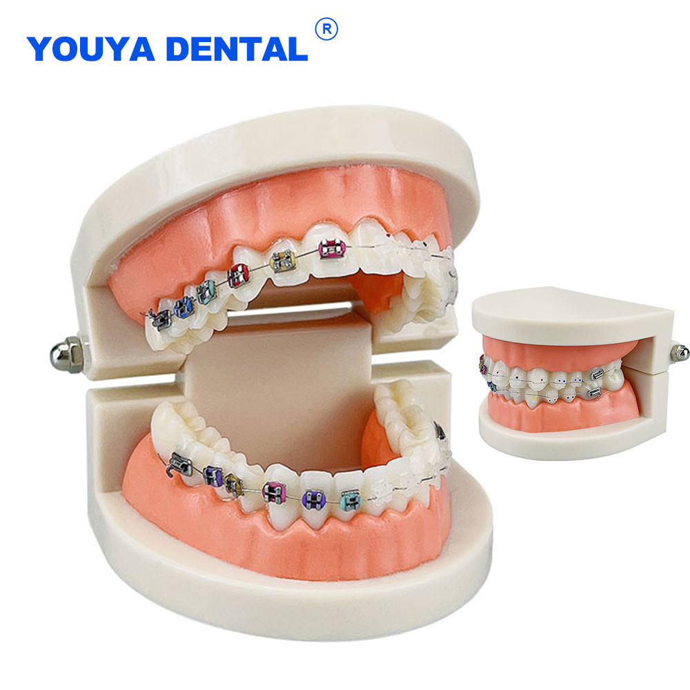 Jual Standard Teeth Model Dental Orthodontic Treatment Model Half ...