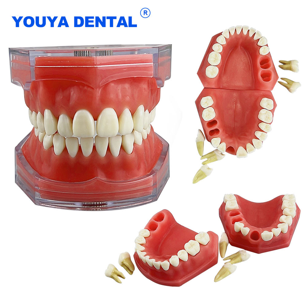 Jual Dental Model Removable Teeth Model Detachable Implant Soft Gum ...