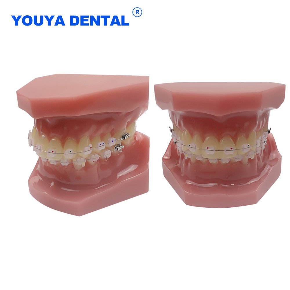 Jual Dental Orthodontic Teeth Model With Braces With Ortho Ceramic ...