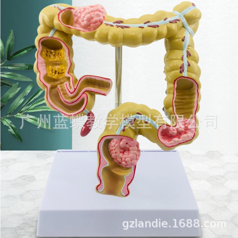 Jual New 1/2 Life Size Human Rectal Pathology Colon Model Large ...