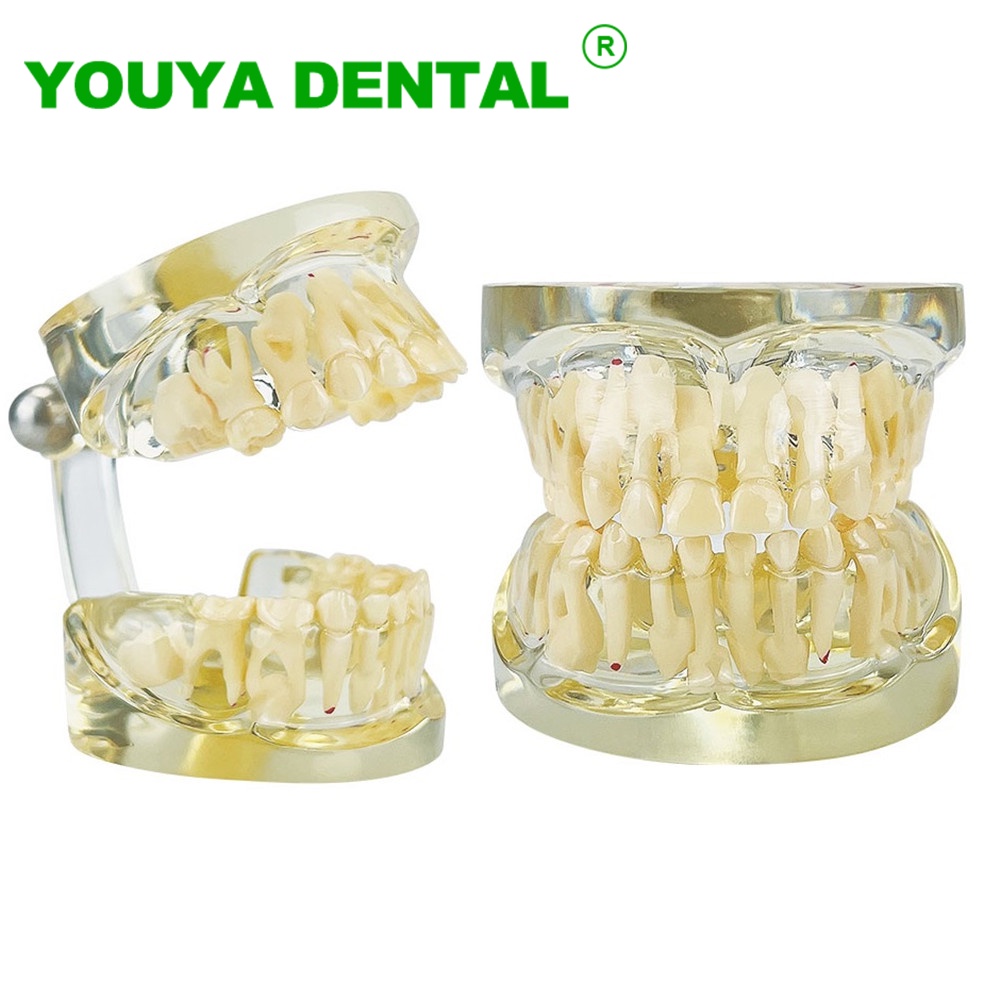Jual New Dental Education Model Transparent Kids Milk Primary Teeth ...