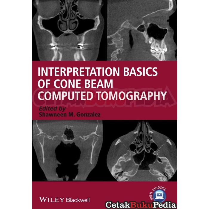Jual Book Interpretation Basics Cone Beam Computed Tomography | Shopee ...