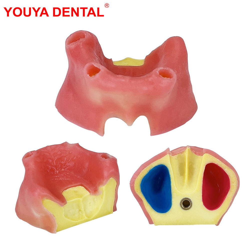 Jual 1pcs Dental Model For Maxillary Sinus With Soft Gums Implant ...