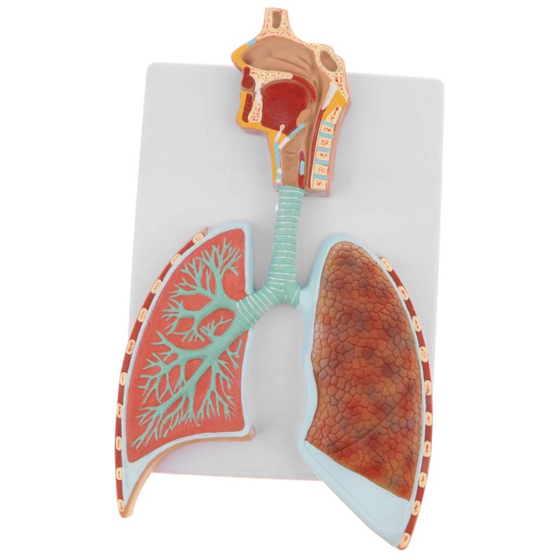 Jual NEW Human Respiratory System Lung Lobes Alveoli Anatomy Model ...