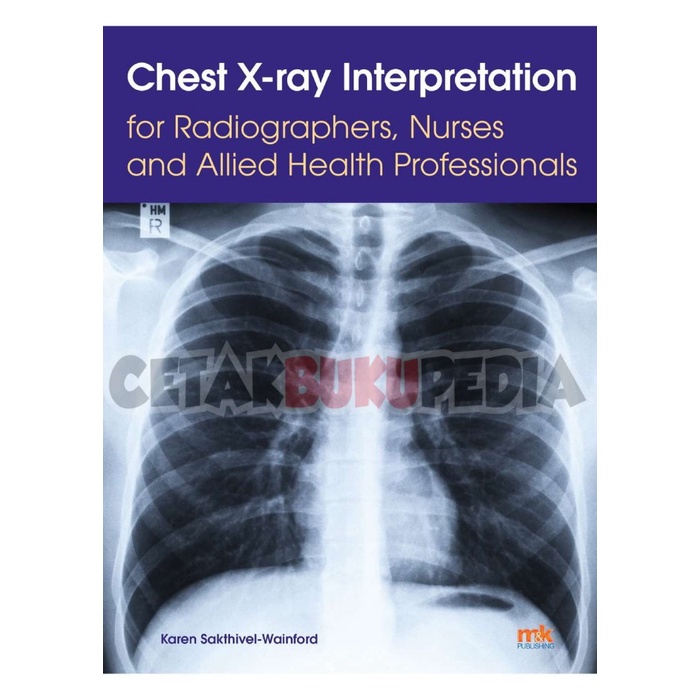 Jual Book Chest X Ray Interpretation Radiographers Nurses And Softcover ...