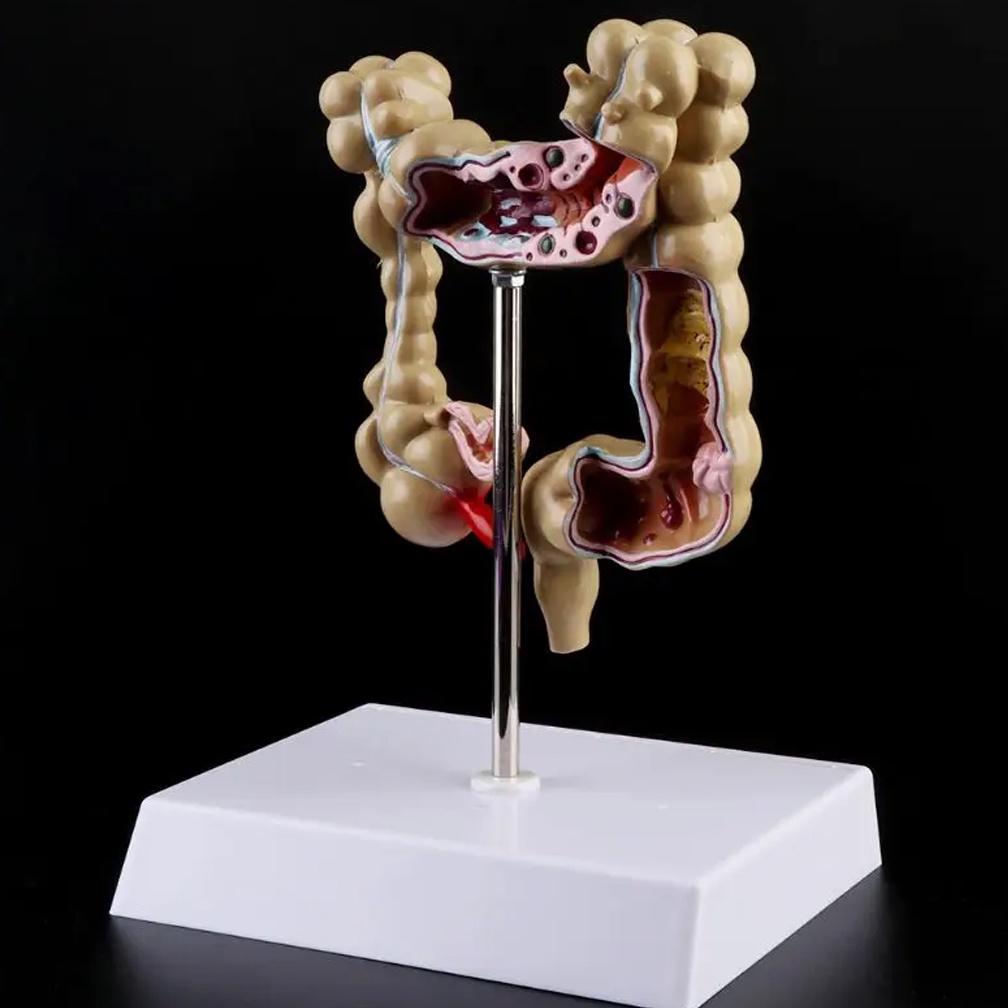 Jual New Professional Colon Model Human Body Anatomy Replica of Colon W ...