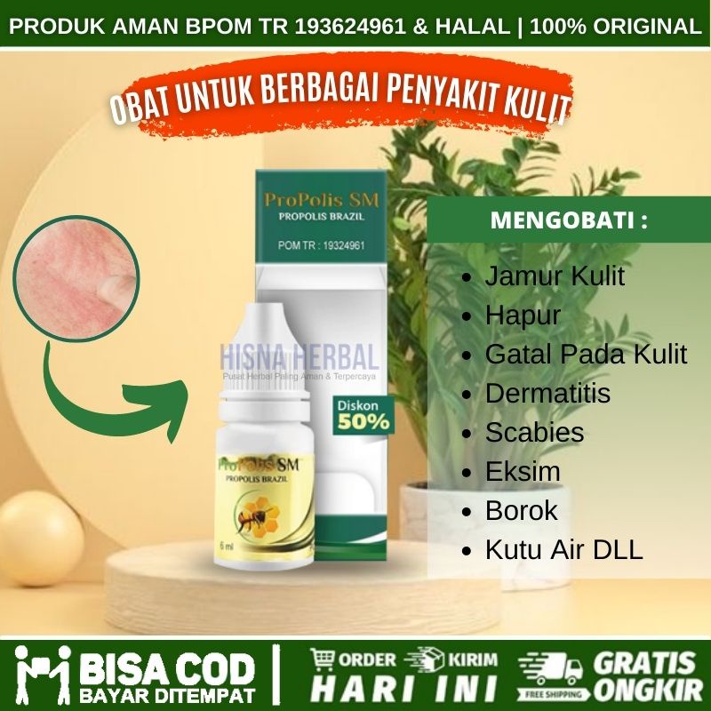 Jual Obat Panu Di Wajah Anak Dan Dewasa Cairan Penghilang Kadas Kurap